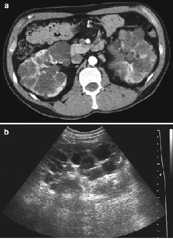 case report 1-1