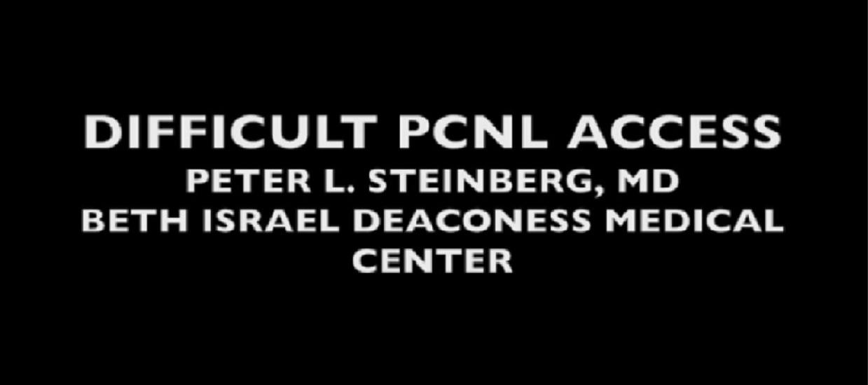 DIFFICULT PCNL ACCESS /KEY POINT