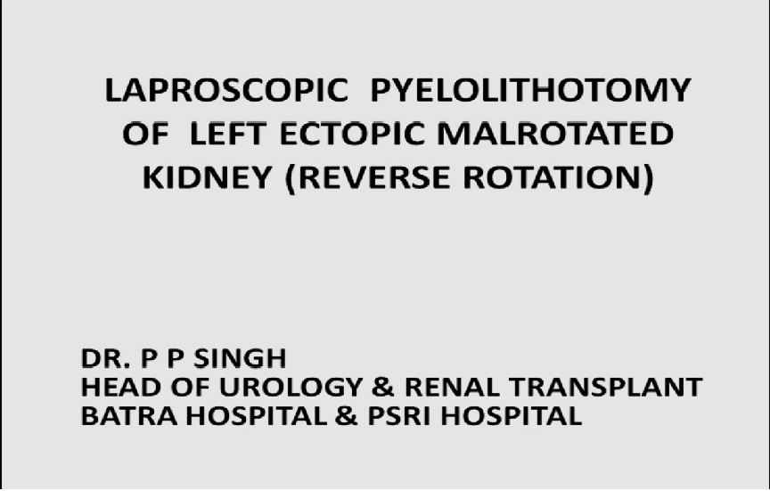 pyelolithotomy -LAP