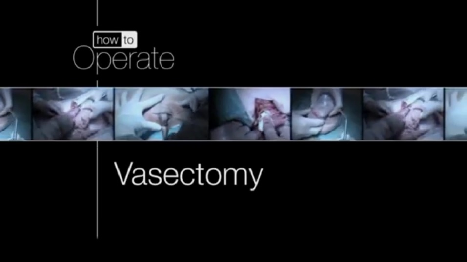 HOW TO OPRATE VASECTOMY