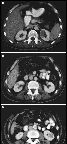 case report 1-1-6