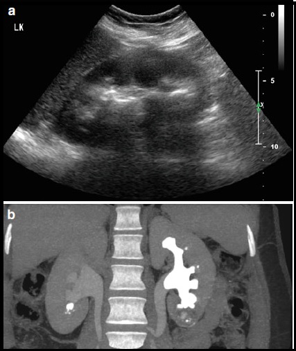 Case report 1-1-8