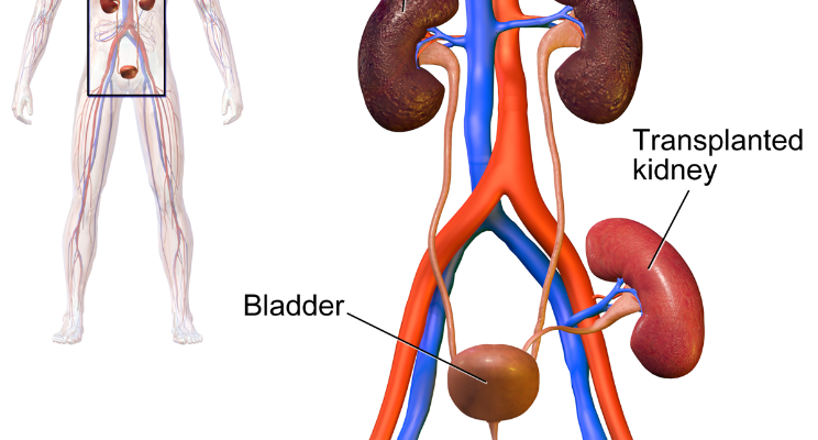 transplanation animation 