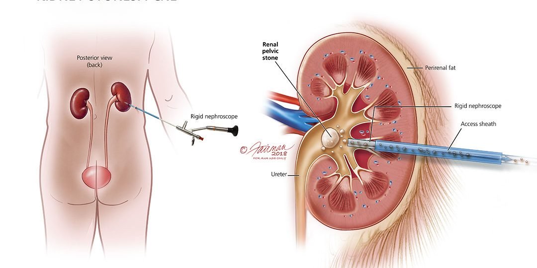 Academic Learning Of Urology Procedures image