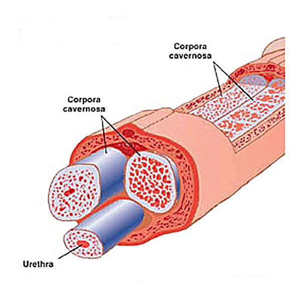 penile fracture with urethral injury vertical incision