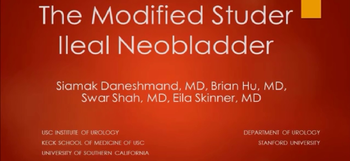 The modified studer ileal neobladder