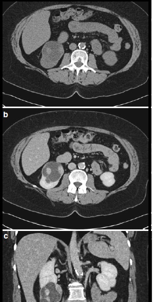 case report 1-1-3