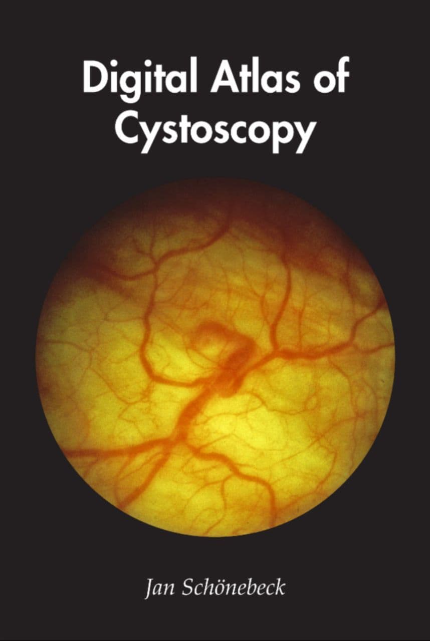 Digital Atlas of Cystoscopy