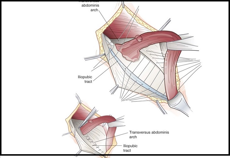 Academic Learning Of Urology Procedures