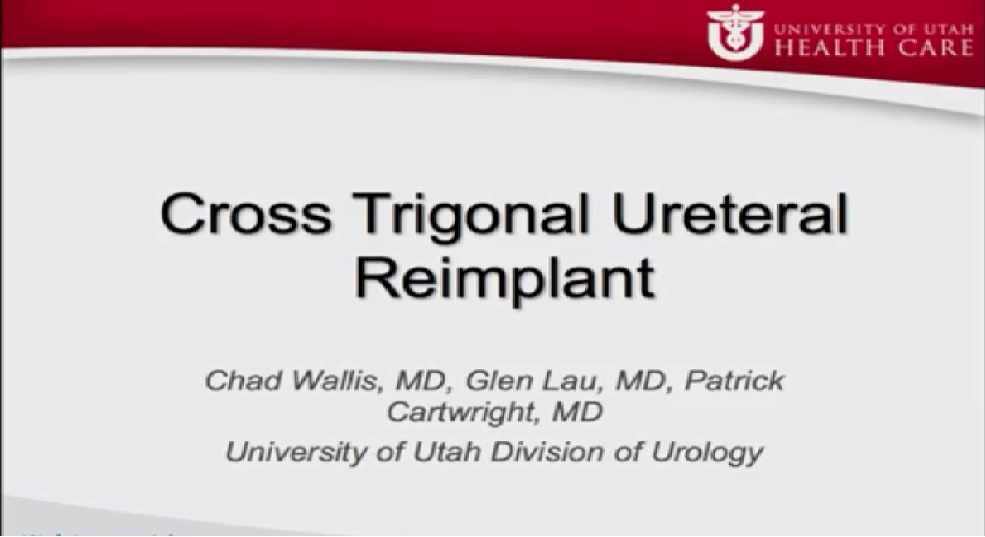 CROSS TRIGONAL URETERLAL REIMPLANT(ANTI REFLUX SURGERY)