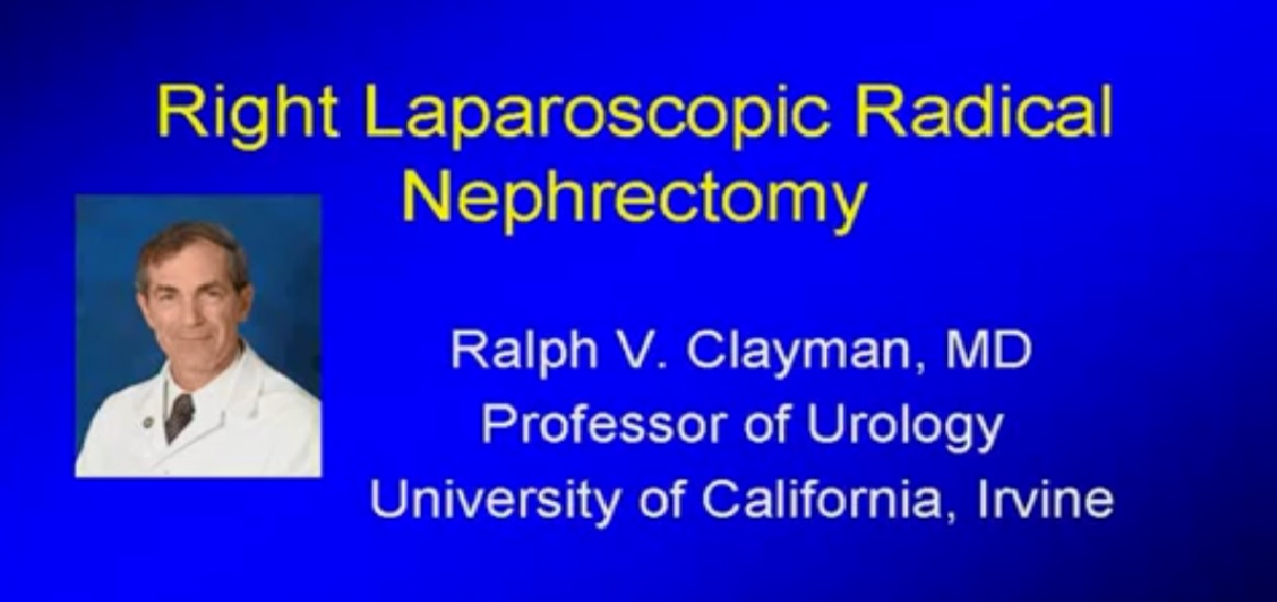 right laparoscopic radical nephrectomy part-2