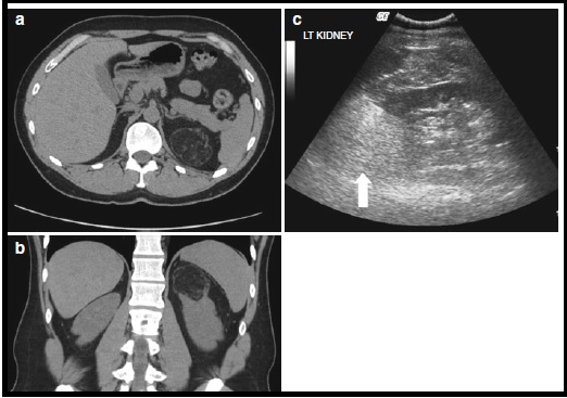 Case Report 1-1-4