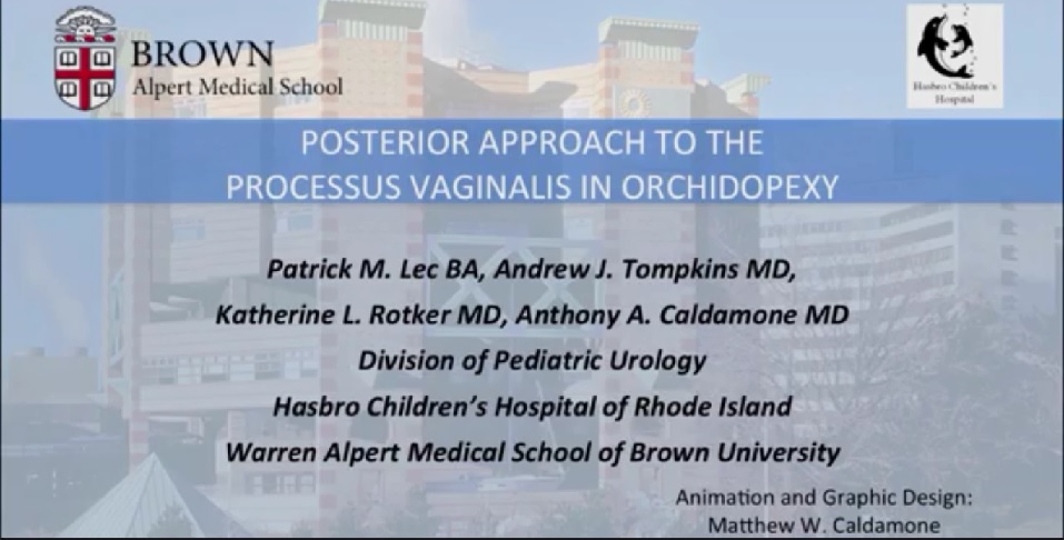 POSTERIOR APPROACH TO THE PROCESSUS VAGINALIS IN ORCHIDOPEXY
