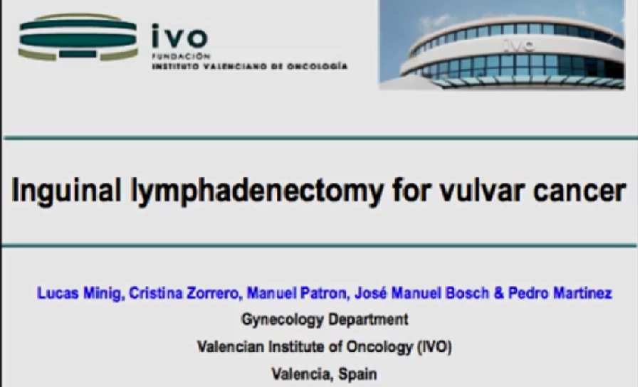 Inguinal lymphadenectomy for vulvar cancer