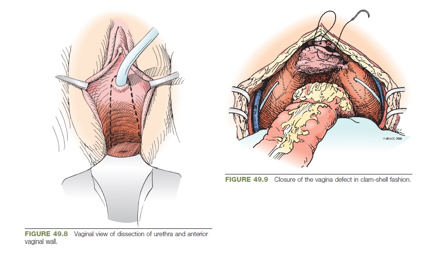 Academic Learning Of Urology Procedures photo