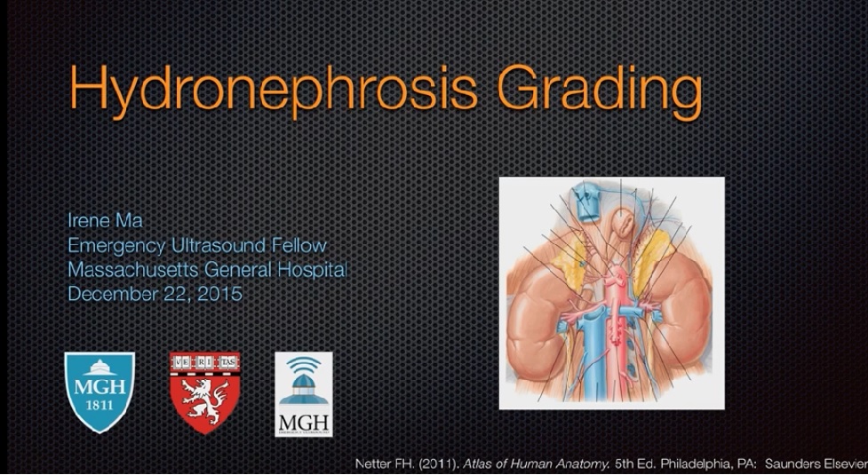 Hydronephrosis Grading By Ultrasonography