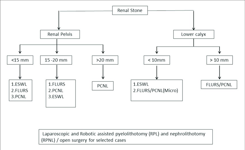 Update on Surgical Management of Pediatric Urolithiasis