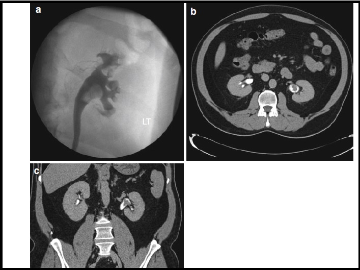 CASE REPORT 1-1-5