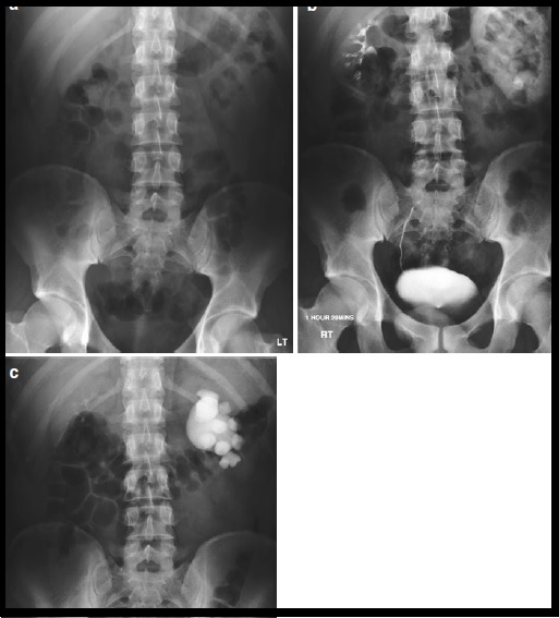 case1-1-10