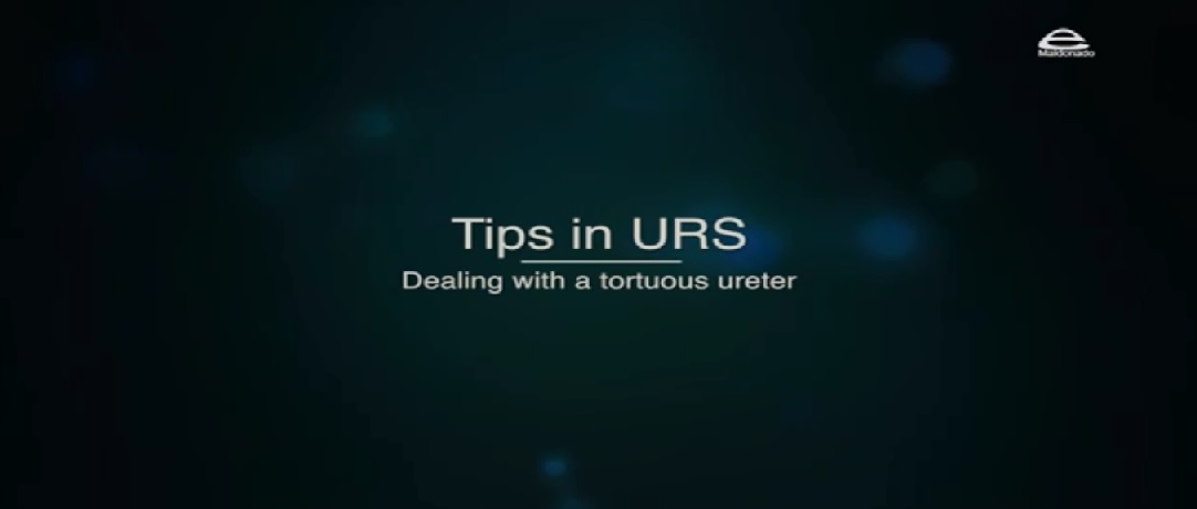 NewTIPS IN URS.- Dealing with a tortuous ureter folder