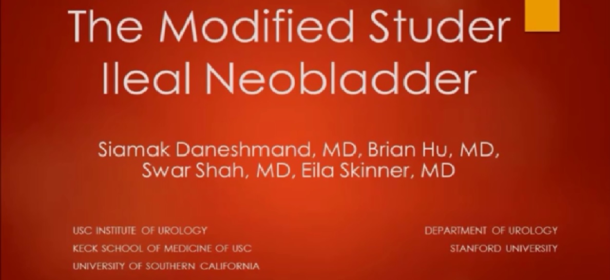 The modified studer ileal neobladder