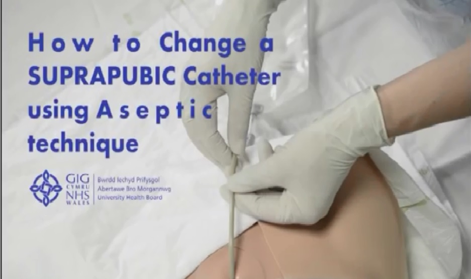 HOW TO CGANGE A SUPRAPUBIC CATHETER