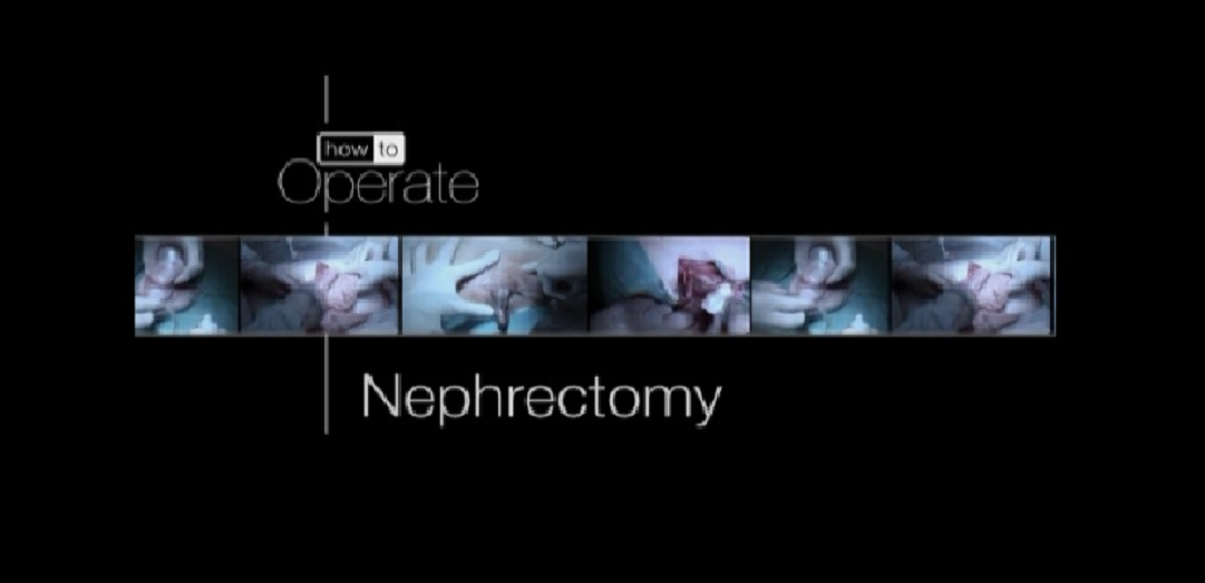 Academic Learning Of Urology Procedures - (simple nephrectomy)part-2