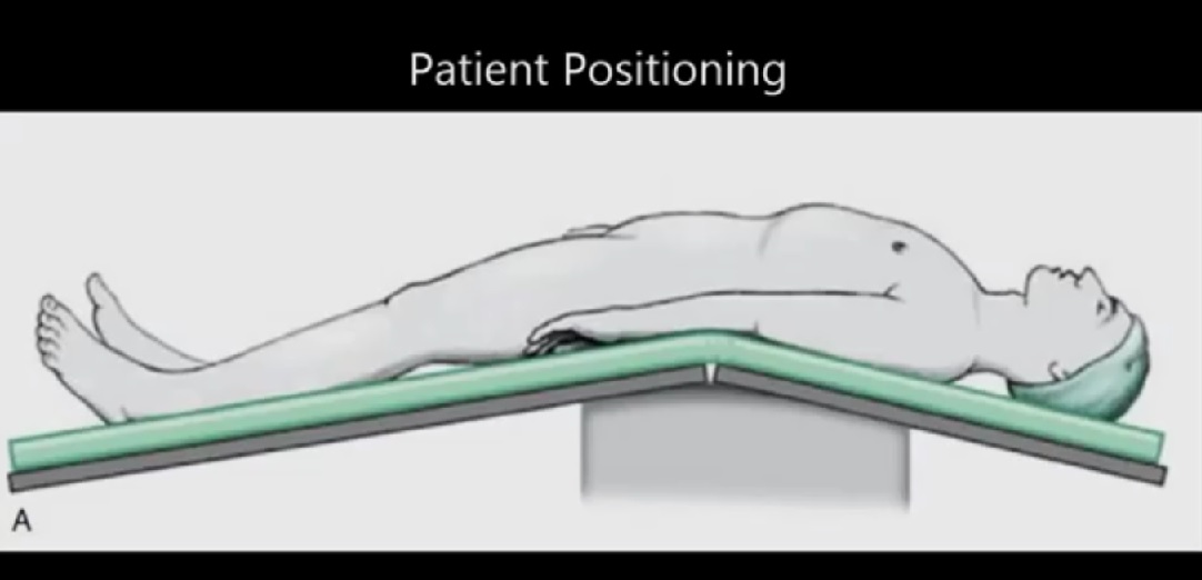 male radical cystectomy